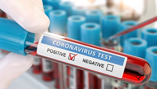 Eine Hand hält ein Teströhrchen mit der Aufschrift Coronavirus Test