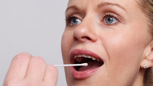 Junge Frau mit geöffnetem Mund, bei der mit einem Abstrichtupfer ein Abstrich zum MRSA-Test genommen wird. 